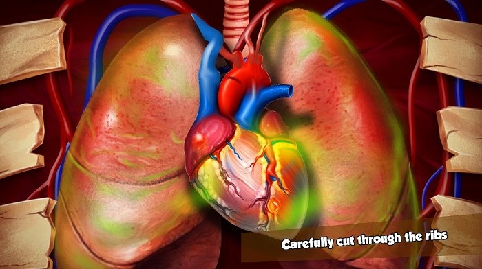 模拟心脏手术游戏(heart surgery)