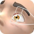 眼科医生免费版v0.2