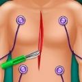 心脏外科医院(Heart Surgery)